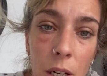 La Chepi apareció con un ojo inflamado y se sinceró con sus seguidores: «Las cosas explotan por algún lado, ¿no?»