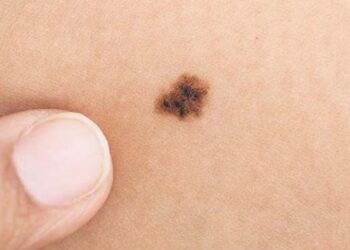 La 29va Campaña Nacional del Prevención del Cáncer de piel de la Sociedad Argentina de Dermatología