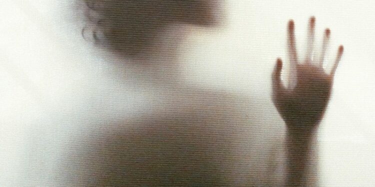 La anorexia: cuando la delgadez al extremo se siente tan bien