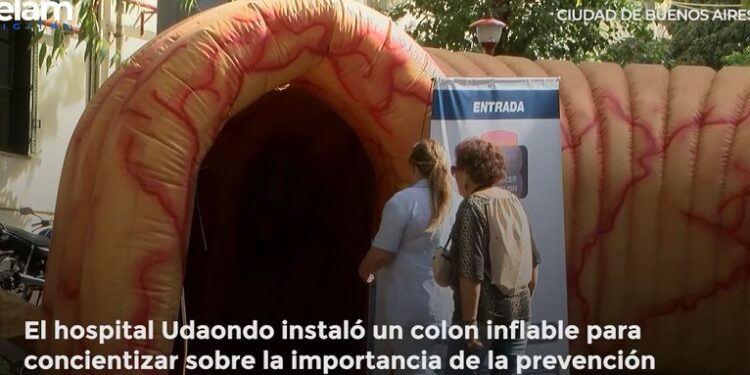 Colocan un colon gigante en el Hospital Udaondo para advertir que el cáncer «es prevenible»