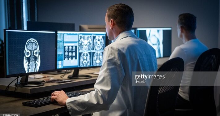 Un código de barras permite rastrear tumor cerebral