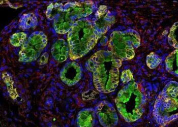 Señalan una proteína antibacteriana como posible diana contra el cáncer de páncreas