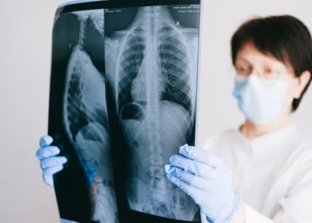 El cáncer de pulmón afecta a la salud sexual del 60 % de los pacientes