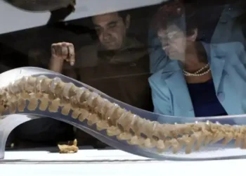 Fractura de vértebras por osteoporosis: Mujer, 76 años y no siempre tratada