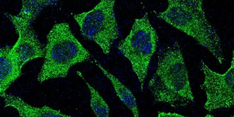 Identifican el gen de un agresivo cáncer infantil