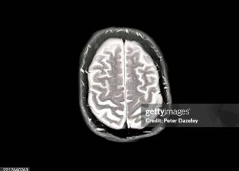 Descubren una proteína que rejuvenece el cerebro y podría revertir el Alzheimer