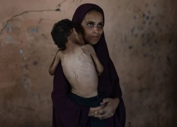 Han muerto más gazatíes por desnutrición en lo que va de 2025 que en los dos años previos