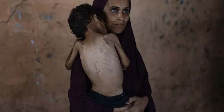 Han muerto más gazatíes por desnutrición en lo que va de 2025 que en los dos años previos