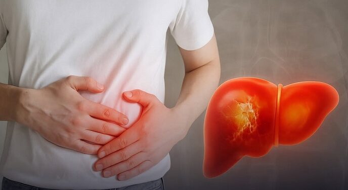 Estos son los hábitos que más perjudican tu hígado