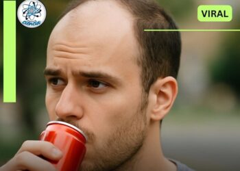 Científicos revelan consumo frecuente de bebidas azucaradas que tiene relación con la calvicie