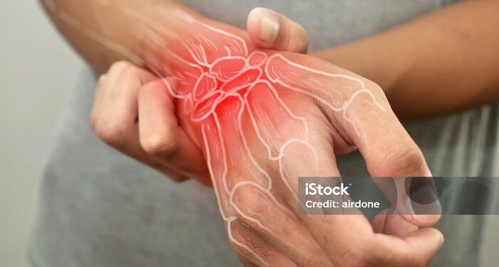 Descubren una proteína que ayuda a formar huesos más fuertes y podría tratar la osteosporosis