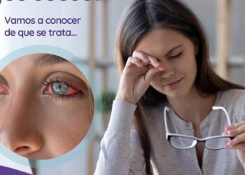 ¿Sentís los Ojos Secos?