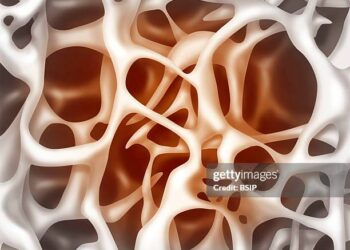Descubren una proteína que ayuda a formar huesos más fuertes y podría tratar la osteoporosis