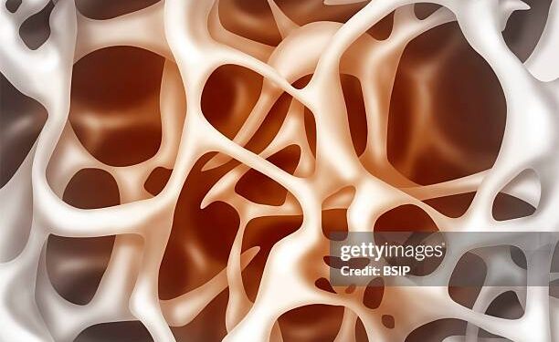 Descubren una proteína que ayuda a formar huesos más fuertes y podría tratar la osteoporosis
