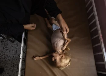 Las muertes por hambre en Gaza se disparan: en agosto fallecieron 185 personas por esta causa