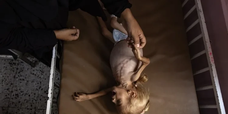 Las muertes por hambre en Gaza se disparan: en agosto fallecieron 185 personas por esta causa