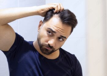 Descubren un novedoso método que podría revertir la alopecia