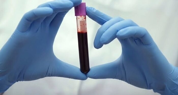 La sangre de las personas más longevas revela los secretos de un envegecimiento más saludable