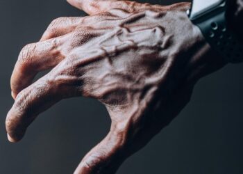 Las venas visibles en las manos no siempre significan envejecimiento