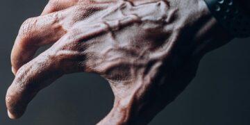 Las venas visibles en las manos no siempre significan envejecimiento
