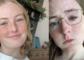 Grace Jamison perdiò la visiòn tras bañarse con las lentes de contacto puestas